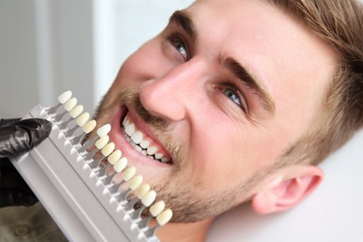 Shade guide held to man’s teeth