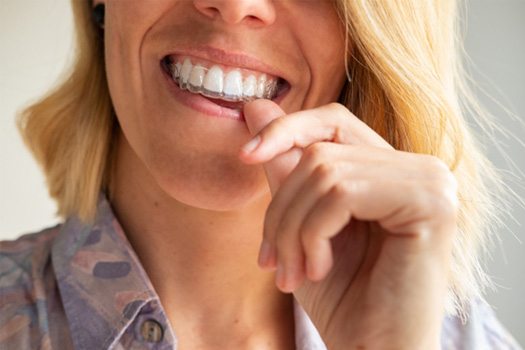 We are proud to offer Invisalign near Tuckahoe